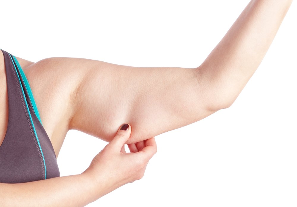 Arm Lift procedure