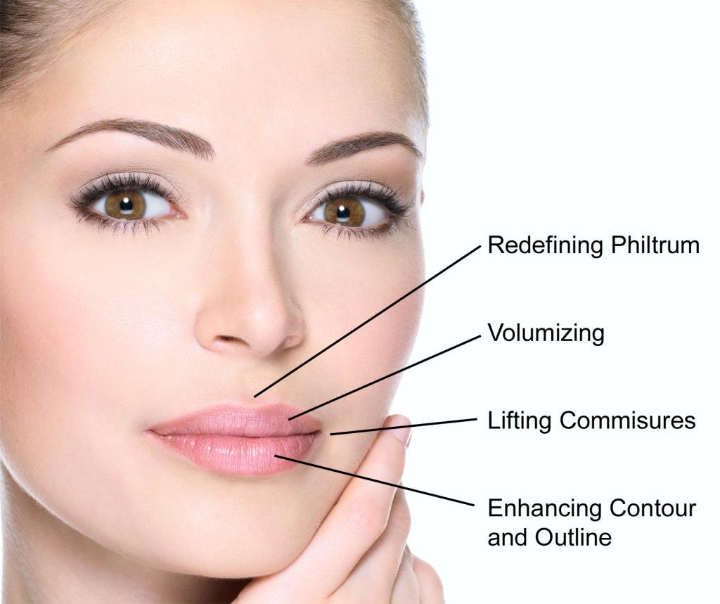 Facial Fillers procedure